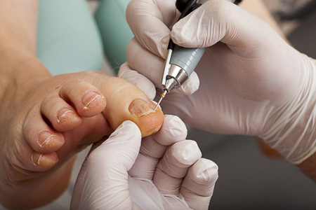 Pédicure médical·e>